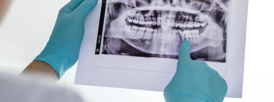 Cirugía Maxilofacial